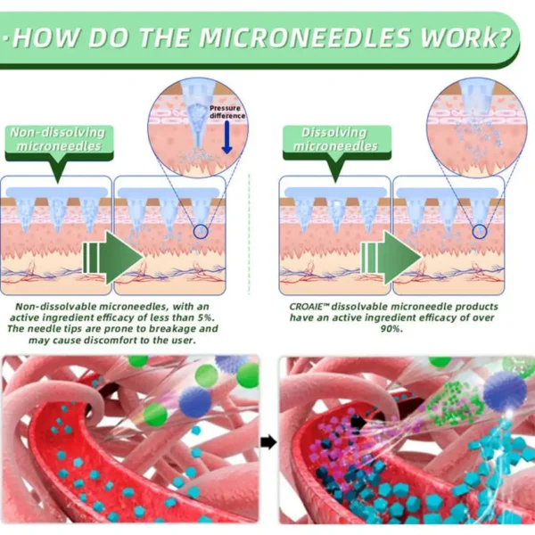 Croaie™ SMGT-GLP-1 Nano Microneedle Patch