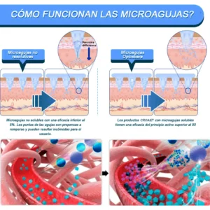 CROAIE® SMGT-GLP-1 Nano-Parche de Microagujas