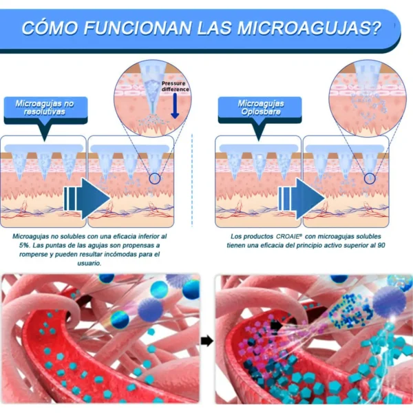CROAIE® SMGT-GLP-1 Nano-Parche de Microagujas