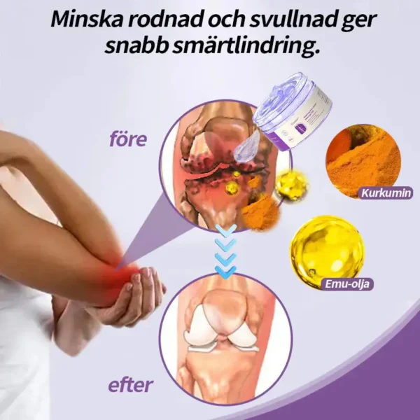 Croaie™ Gurkmeja & Emuolja Artrit Lugnande Smärtlindrande Massage Gel