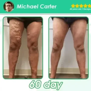 𝑪𝒓𝐨𝒂𝗶𝗲® 𝐆 𝐋 𝐏-𝟏 𝗠𝗲𝘁𝗮𝗯𝗼𝗹𝗶𝗰 Support – 𝗨𝗹𝘁𝗿𝗮 𝗖𝗼𝗻𝗰𝗲𝗻𝘁𝗿𝗮𝘁𝗲𝗱 𝗟𝗶𝗾𝘂𝗶𝗱 𝗣𝗲𝗮𝗿𝗹𝘀 𝘄𝗶𝘁𝗵 𝗡𝗔𝗗+, 𝗠𝗼𝗿𝗶𝗻𝗴𝗮 & 𝗔𝗖𝗩 – 𝗔𝗽𝗽𝗲𝘁𝗶𝘁𝗲 𝗖𝗼𝗻𝘁𝗿𝗼𝗹, 𝗪𝗲𝗶𝗴𝗵𝘁 𝗠𝗮𝗻𝗮𝗴𝗲𝗺𝗲𝗻𝘁 & 𝗖𝗮𝗿𝗱𝗶𝗼𝘃𝗮𝘀𝗰𝘂𝗹𝗮𝗿 𝗦𝘂𝗽𝗽𝗼𝗿𝘁