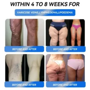 ๐ถ๐๐๐ด๐๐ยฎ ๐๐๐๐๐๐๐๐ ๐๐ข๐๐๐๐๐ก ๐ท๐๐๐๐