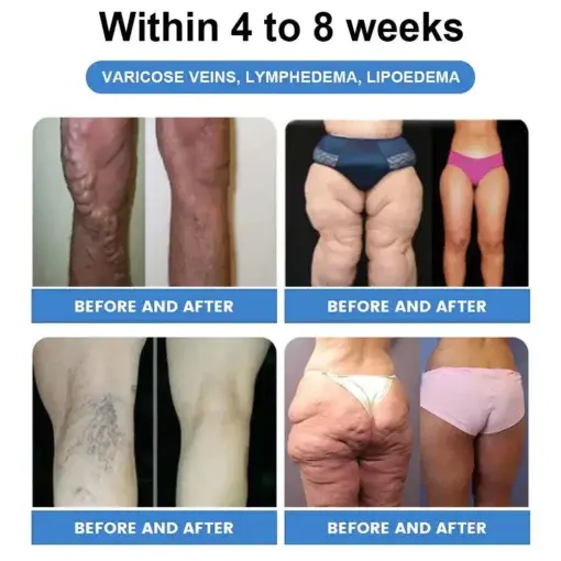 ๐ถ๐
๐๐ด๐ผ๐ธยฎ ๐บ๐ฟ๐-1 ๐๐๐๐โ๐ก ๐ฟ๐๐ ๐ ๐๐๐๐ ๐๐๐๐ข๐ก๐๐๐