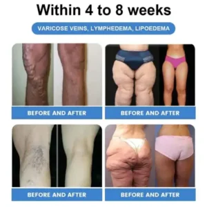 𝐶𝑅𝑂𝐴𝐼𝐸® 𝐺𝐿𝑃-1 SLIMMING & HEALTH BOOST DROPS