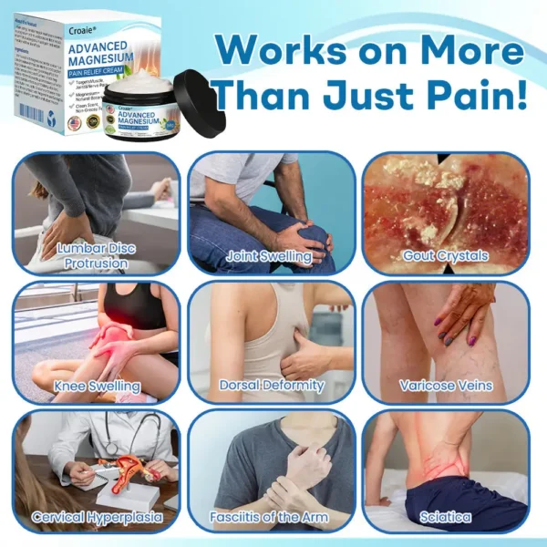 Croaie® Advanced Magnesium Pain Relief Cream(Treats Arthritis, Neuropathy, Rheumatism, Sports Injuries & More)