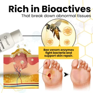 Croaie® Bee Venom Diabetic Foot Ulcer Spray