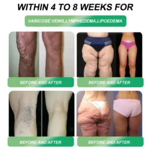 Croaie® GLP-1 Weight Loss Drops