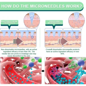 【Last Day Promotion 60% OFF👨‍⚕️】Croaie® SIX IN-ONE NIDDK-Tirzepatide Health NANO MICRONEEDLE PATCH 👨‍⚕️（Zero Pain, 24/7 Release | Lose 20lbs FAST | 90% Sugar Drop | ） 🌝