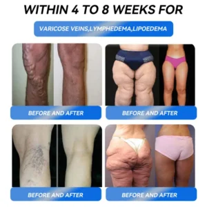 𝘾𝙧𝙤𝘼𝙞𝙚® 𝙎𝙡𝙞𝙢𝙢𝙞𝙣𝙜 𝙎𝙪𝙥𝙥𝙤𝙧𝙩 𝘿𝙧𝙤𝙥𝙨 ✅ 𝑂𝑏𝑒𝑠𝑖𝑡𝑦, 𝐶𝑎𝑟𝑑𝑖𝑜𝑣𝑎𝑠𝑐𝑢𝑙𝑎𝑟 𝐷𝑖𝑠𝑒𝑎𝑠, 𝐷𝑖𝑎𝑏𝑒𝑡𝑒𝑠, 𝑆𝑙𝑒𝑒𝑝 𝐴𝑝𝑛𝑒𝑎, 𝐽𝑜𝑖𝑛𝑡 𝑃𝑟𝑜𝑏𝑙𝑒𝑚𝑠 𝑎𝑛𝑑 𝑀𝑜𝑟𝑒