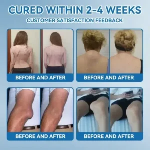 ๐๐ซ๐จ๐๐ข๐ยฎ ๐๐๐-๐๐๐ ๐๐จ๐ข๐ง๐ญ ๐๐๐๐ฅ๐ข๐ง๐ ๐๐ซ๐๐๐ฆ