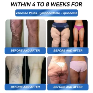 ๐๐๐๐๐๐๐๐ ๐๐ก๐๐๐ | Croaieยฎ๐จโโ๏ธ๐บ๐ซ๐-1 ๐๐๐๐โ๐ก ๐ฟ๐๐ ๐ ๐๐๐๐ ๐๐๐๐ข๐ก๐๐๐ ๐ Just one week, visible changes in 7 days For obesity, cardiovascular health, diabetes, sleep apnea, joint issues, and more