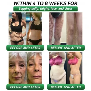 𝙊𝙛𝙛𝙞𝙘𝙞𝙖𝙄 𝙎𝙩𝙤𝙧𝙚 | croaie® 𝙂𝙇𝙋-1 & 𝙈𝙖𝙩𝙧𝙞𝙭𝙮𝙡 3000 𝙎𝙡𝙞𝙢𝙢𝙞𝙣𝙜 & 𝙃𝙚𝙖𝙡𝙩𝙝 𝘿𝙧𝙤𝙥𝙨 ✅ 𝙅𝙪𝙨𝙩 𝙤𝙣𝙚 𝙙𝙤𝙨𝙚 𝙖 𝙙𝙖𝙮 — 𝙫𝙞𝙨𝙞𝙗𝙡𝙚 𝙧𝙚𝙨𝙪𝙡𝙩𝙨 𝙞𝙣 𝙟𝙪𝙨𝙩 7 𝙙𝙖𝙮𝙨 💧𝙁𝙤𝙧 𝙤𝙗𝙚𝙨𝙞𝙩𝙮, 𝙘𝙖𝙧𝙙𝙞𝙤𝙫𝙖𝙨𝙘𝙪𝙡𝙖𝙧 𝙝𝙚𝙖𝙡𝙩𝙝, 𝙙𝙞𝙖𝙗𝙚𝙩𝙚𝙨, 𝙨𝙡𝙚𝙚𝙥 𝙖𝙥𝙣𝙚𝙖, 𝙟𝙤𝙞𝙣𝙩 𝙞𝙨𝙨𝙪𝙚𝙨, 𝙖𝙣𝙙 𝙢𝙤𝙧𝙚🥇