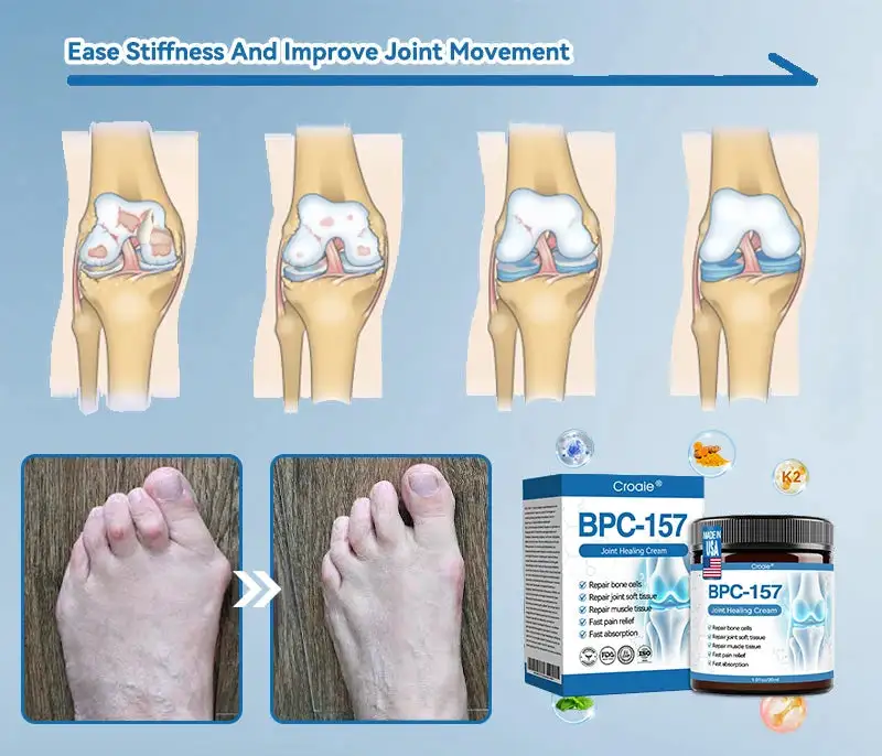 𝐂𝐫𝐨𝐚𝐢𝐞® BPC-157 Joint Healing Cream🦴Treats Arthritis. Neuropathy. Rheumatism. Sports Injuries & More🦵