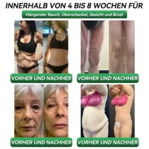 CROAIE® 𝗚𝗟𝗣-𝟭 & 𝗠𝗮𝘁𝗿𝗶𝘅𝘆𝗹 𝟯𝟬𝟬𝟬 𝗦𝗰𝗵𝗹𝗮𝗻𝗸𝗵𝗲𝗶𝘁𝘀- & 𝗚𝗲𝘀𝘂𝗻𝗱𝗵𝗲𝗶𝘁𝘀-𝗧𝗿𝗼𝗽𝗳𝗲𝗻