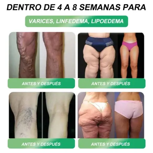 Croaieยฎ ๐๐๐-๐ ๐บ๐ฐ๐ฟ-๐ฐ๐ต-๐ถ๐ต๐ฌ ๐ฏ๐๐๐๐๐ ๐บ๐๐๐๐๐๐๐ ๐ถ๐๐๐ ๐ณ๐๐๐๐๐