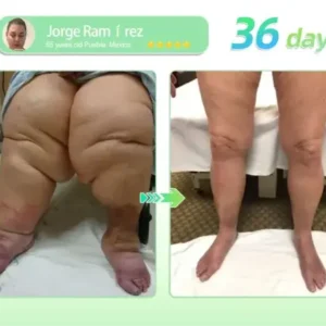 Croaieยฎ ๐๐๐-๐ ๐บ๐ฐ๐ฟ-๐ฐ๐ต-๐ถ๐ต๐ฌ ๐ฏ๐๐๐๐๐ ๐บ๐๐๐๐๐๐๐ ๐ถ๐๐๐ ๐ณ๐๐๐๐๐