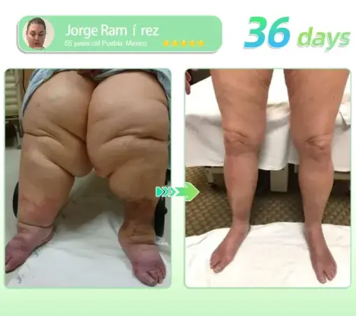 Croaieยฎ ๐๐๐-๐ ๐บ๐ฐ๐ฟ-๐ฐ๐ต-๐ถ๐ต๐ฌ ๐ฏ๐๐๐๐๐ ๐บ๐๐๐๐๐๐๐ ๐ถ๐๐๐ ๐ณ๐๐๐๐๐