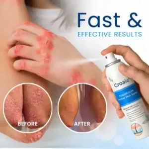 Croaie® Magnesium Herbal Skin Spray