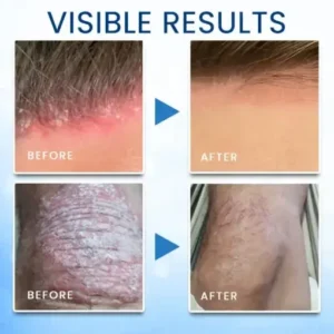 Croaie® Magnesium Herbal Skin Spray