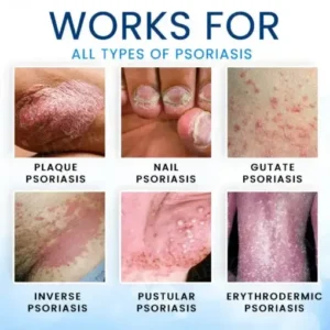 Croaie® Magnesium Herbal Skin Spray