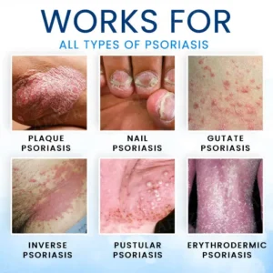 🌿FDA-APPROVED✅Croaie® Magnesium Herbal Skin Spray - Removes Skin Blemishes, Repairs Damaged Skin, Brightens & Anti-Aging Care