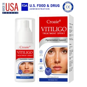 🔥FDA Approved⭐ WHO Approved🌍 Croaie® Vitiligo Treatment Spray - No allergies🌸 Quick and effective⚡️ With over 150,000 sold!📦