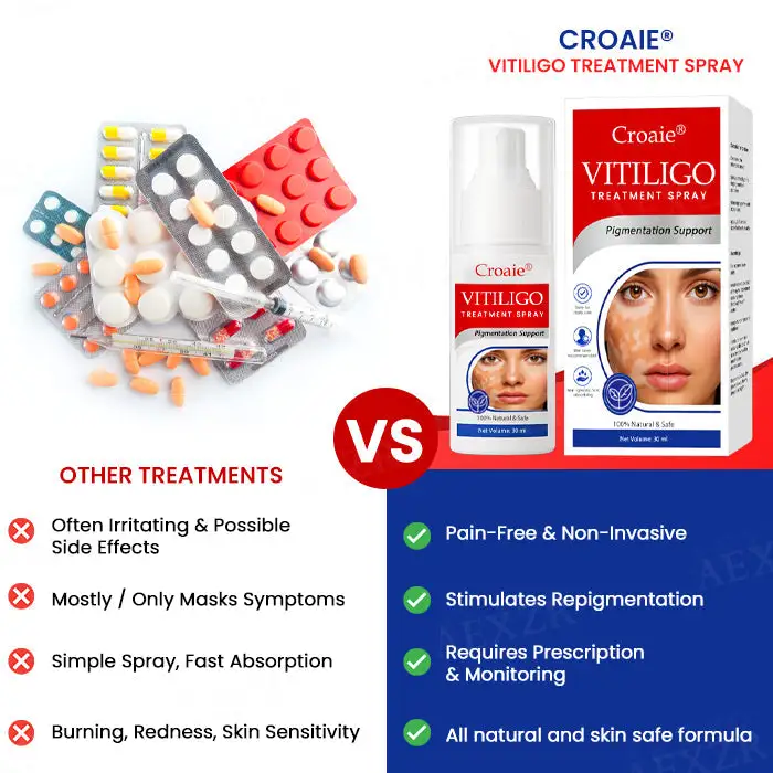 🔥FDA Approved⭐ WHO Approved🌍 Croaie® Vitiligo Treatment Spray - No allergies🌸 Quick and effective⚡️ With over 150,000 sold!📦