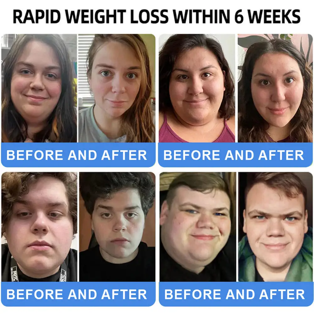 ใLast Day Promotion 75% OFFโกใCroaieยฎ ๐๐๐-๐ ๐๐๐+ ๐-๐ข๐ง-๐ ๐๐๐๐ฅ๐ญ๐ก ๐๐ฎ๐ฉ๐ฉ๐จ๐ซ๐ญ ๐๐ข๐ช๐ฎ๐ข๐ ๐๐ซ๐จ๐ฉ๐ฌ ๐ชUse once every two days | Lose 20 pounds quickly | Reduce sugar by 90%