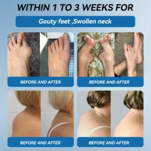 | Last Day Promotion 80% OFF | 🇺🇸 𝐂𝐫𝐨𝐚𝐢𝐞® BPC-157 Joint Healing Cream🦴Treats Arthritis. Neuropathy. Rheumatism. Sports Injuries & More🦵