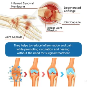 | Last Day Promotion 80% OFF | 🇺🇸 𝐂𝐫𝐨𝐚𝐢𝐞® BPC-157 Joint Healing Cream🦴Treats Arthritis. Neuropathy. Rheumatism. Sports Injuries & More🦵