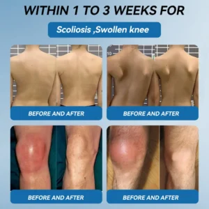 | Last Day Promotion 80% OFF | 🇺🇸 𝐂𝐫𝐨𝐚𝐢𝐞® BPC-157 Joint Healing Cream🦴Treats Arthritis. Neuropathy. Rheumatism. Sports Injuries & More🦵