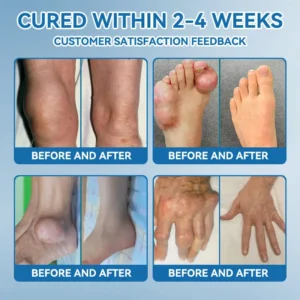 | Last Day Promotion 80% OFF | 🇺🇸 𝐂𝐫𝐨𝐚𝐢𝐞® BPC-157 Joint Healing Cream🦴Treats Arthritis. Neuropathy. Rheumatism. Sports Injuries & More🦵