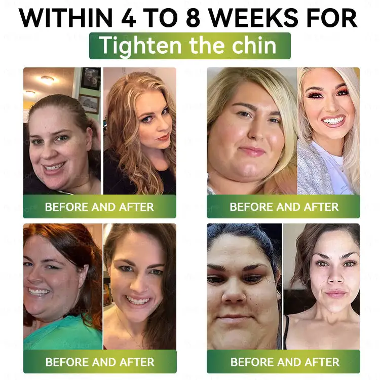 Official Store | ✨Croaie® SMGT-GLP-1 Nano Microneedle Patch with Collagen Peptides &Matrixyl 3000|Clinically Backed Slimming, Firming & Glucose Control|7-Day Results|Needle-Free Application 💡