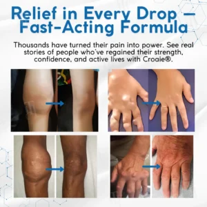 ✨𝐂𝐫𝐨𝐚𝐢𝐞® 𝐁𝐏𝐂-𝟏𝟓𝟕 𝐑𝐞𝐜𝐨𝐯𝐚𝐌𝐚𝐱 𝐉𝐨𝐢𝐧𝐭 & 𝐓𝐞𝐧𝐝𝐨𝐧 𝐋𝐢𝐪𝐮𝐢𝐝❗