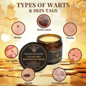 CROAIE ADVANCEDยฎ ๐๐ฌ๐จ๐ซ๐ข๐๐ฌ๐ข๐ฌ & ๐๐๐ณ๐๐ฆ๐ ๐๐๐ฅ๐ข๐๐ ๐๐ซ๐๐๐ฆ ๐โ
Clinically Proven ๐ฉโโ๏ธDermatologist Trusted ยท ๐บ๐ธFDA Certification