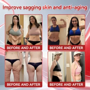 Croaieยฎ ๐ฎ๐๐ฃ-๐ญ + ๐ช๐๐๐๐๐๐๐ฃ ๐๐๐ฉ๐๐๐
๐๐ ๐พ๐๐๐ด๐ต๐ ๐๐จ๐ฌ๐ฌ & ๐ญ๐๐๐๐๐ฃ๐ ๐ถ๐๐๐ฅ ๐บ๐๐ฅ๐๐๐๐๐ ๐๐ ๐ผ๐ฏ๐ฒ๐๐ถ๐๐, ๐ณ๐ถ๐ฟ๐บ๐ ๐๐ธ๐ถ๐ป, ๐ฐ๐ฎ๐ฟ๐ฑ๐ถ๐ผ๐๐ฎ๐๐ฐ๐๐น๐ฎ๐ฟ ๐ฑ๐ถ๐๐ฒ๐ฎ๐๐ฒ, ๐ฑ๐ถ๐ฎ๐ฏ๐ฒ๐๐ฒ๐, ๐๐น๐ฒ๐ฒ๐ฝ ๐ฎ๐ฝ๐ป๐ฒ๐ฎ, ๐ท๐ผ๐ถ๐ป๐ ๐ฝ๐ฟ๐ผ๐ฏ๐น๐ฒ๐บ๐, ๐ฎ๐ป๐ฑ ๐บ๐ผ๐ฟ๐ฒ