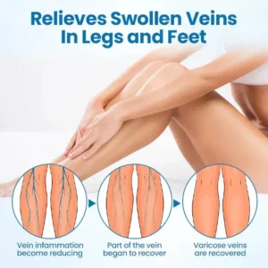 Croaie® VenoEase Herbal Spray-✅ Clinically proven to eliminate varicose veins in just 7 days!