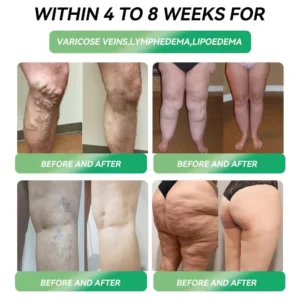 MHRA 🇬🇧 | Official UK 🇬🇧 Store — Croaie® Telportide Oral Solution, GIP and GLP-1 Dual-Action Weight Loss Solution, One Bottle Daily, Results in 7 Days🛍️