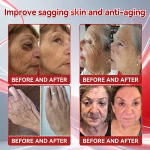 🇺🇸New Arrival Croaie® 𝑮𝐋𝗣-𝟭 + 𝑪𝒐𝒍𝒍𝙖𝙜𝙚𝙣 𝐏𝐞𝐩𝒕𝒊𝒅𝒆𝒔 𝑾𝒆𝒊𝗴𝗵𝘁 𝐋𝐨𝐬𝐬 & 𝑭𝒊𝒓𝒎𝙞𝙣𝙜 𝑶𝒓𝒂𝐥 𝑺𝒐𝐥𝒖𝒕𝒊𝒐𝒏 💚💚 𝗼𝗯𝗲𝘀𝗶𝘁𝘆, 𝗳𝗶𝗿𝗺𝘀 𝘀𝗸𝗶𝗻, 𝗰𝗮𝗿𝗱𝗶𝗼𝘃𝗮𝘀𝗰𝘂𝗹𝗮𝗿 𝗱𝗶𝘀𝗲𝗮𝘀𝗲, 𝗱𝗶𝗮𝗯𝗲𝘁𝗲𝘀, 𝘀𝗹𝗲𝗲𝗽 𝗮𝗽𝗻𝗲𝗮, 𝗷𝗼𝗶𝗻𝘁 𝗽𝗿𝗼𝗯𝗹𝗲𝗺𝘀, 𝗮𝗻𝗱 𝗺𝗼𝗿𝗲