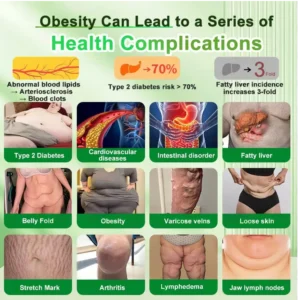 New Arrival🇺🇸CVS Online | Croaie® 𝗚𝗟𝗣-𝟭 𝟐𝟎-𝐢𝐧-𝟏 𝐒𝐥𝐢𝐦 & 𝐇𝐞𝐚𝐥𝐭𝐡 𝐎𝐫𝐚𝐥 𝐒𝐨𝐥𝐮𝐭𝐢𝐨𝐧 -𝑶𝒏𝒄𝒆 𝒂 𝒅𝒂𝒚, 𝒓𝒆𝒔𝒖𝒍𝒕𝒔 𝒊𝒏 6 𝒅𝒂𝒚𝒔, 𝑾𝒊𝒕𝒉 100 𝑩𝒊𝒍𝒍𝒊𝒐𝒏 𝑪𝑭𝑼 𝑨𝒄𝒕𝒊𝒗𝒆 𝑷𝒓𝒐𝒃𝒊𝒐𝒕𝒊𝒄𝒔 ✅ 𝑺𝒖𝒑𝒑𝒐𝒓𝒕𝒔 𝒘𝒆𝒊𝒈𝒉𝒕 𝒎𝒂𝒏𝒂𝒈𝒆𝒎𝒆𝒏𝒕, 𝒉𝒆𝒂𝒓𝒕 𝒉𝒆𝒂𝒍𝒕𝒉, 𝒅𝒊𝒂𝒃𝒆𝒕𝒆𝒔, 𝒈𝒖𝒕 & 𝒘𝒐𝒎𝒆𝒏’𝒔 𝒉𝒆𝒂𝒍𝒕𝒉, 𝒘𝒉𝒊𝒍𝒆 𝒇𝒊𝒓𝒎𝒊𝒏𝒈 𝒔𝒌𝒊𝒏