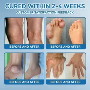 Croaie® ʙ.ᴘ.ᴄ-157 Joint Healing Cream