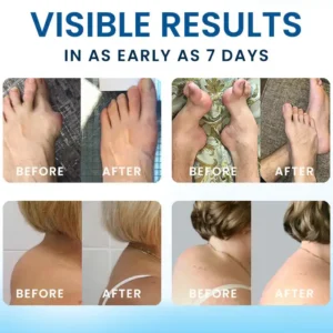 Croaie® BPC-157 Joint Healing Cream💪 From Stiff to Supple: The Deep-Penetrating Cream That Revives Your Joints in 7 Days.