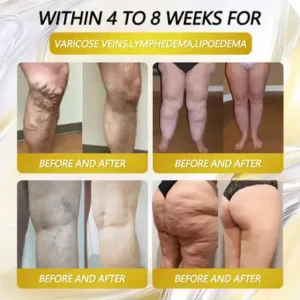 FDA 🇺🇸 |🇺🇸 Official US 🇺🇸 Store — Croaie® Tirzepatide Oral Solution, GIP and GLP-1 Dual-Action Weight Loss Solution, One Bottle Daily, Results in 7 Days✨