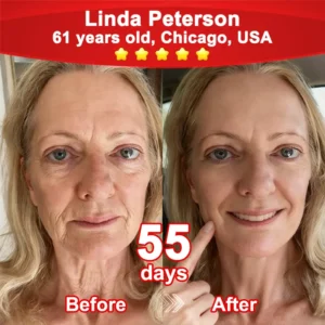 💖𝘾𝙑𝙎'𝙨 𝙊𝙣𝙡𝙞𝙣𝙚💖Croaie® Stem Cell–Powered NAD+ Activating Collagen Peptide Oral Solution |👩‍⚕️ (⭐ Visibly Lift Sagging Skin and Smooth Wrinkles — All From the Inside Out)🌵