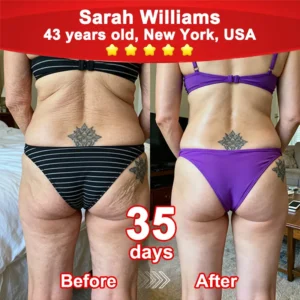 💖𝘾𝙑𝙎'𝙨 𝙊𝙣𝙡𝙞𝙣𝙚💖Croaie® Stem Cell–Powered NAD+ Activating Collagen Peptide Oral Solution |👩‍⚕️ (⭐ Visibly Lift Sagging Skin and Smooth Wrinkles — All From the Inside Out)🌵