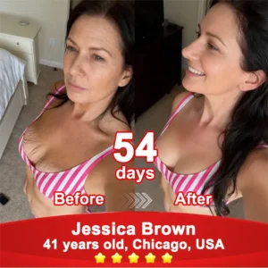 💖𝘾𝙑𝙎'𝙨 𝙊𝙣𝙡𝙞𝙣𝙚💖Croaie® Stem Cell–Powered NAD+ Activating Collagen Peptide Oral Solution |👩‍⚕️ (⭐ Visibly Lift Sagging Skin and Smooth Wrinkles — All From the Inside Out)🌵