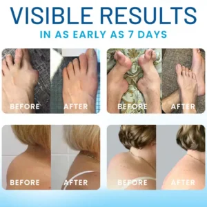 🏷️ EXCLUSIVE DEAL! 50% OFF - Croaie® Joint Relief TB-500 Microneedle Patch