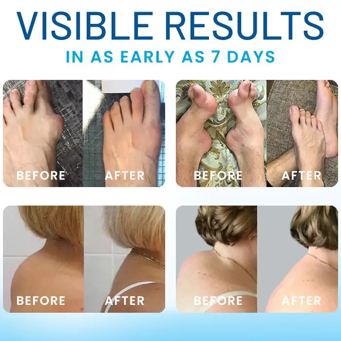 🏷️ EXCLUSIVE DEAL! 50% OFF - Croaie® Joint Relief TB-500 Microneedle Patch