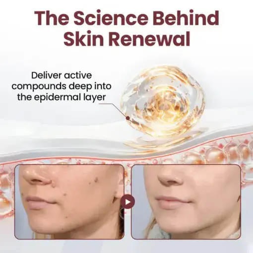 Croaie® KeraErase RICEDUAL-ACTION RENEWAL CREAM