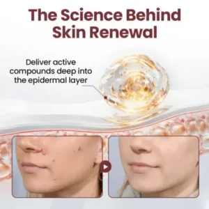 Croaie® KeraErase RICEDUAL-ACTION RENEWAL CREAM